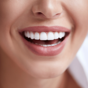white teeth woman smiling mouth